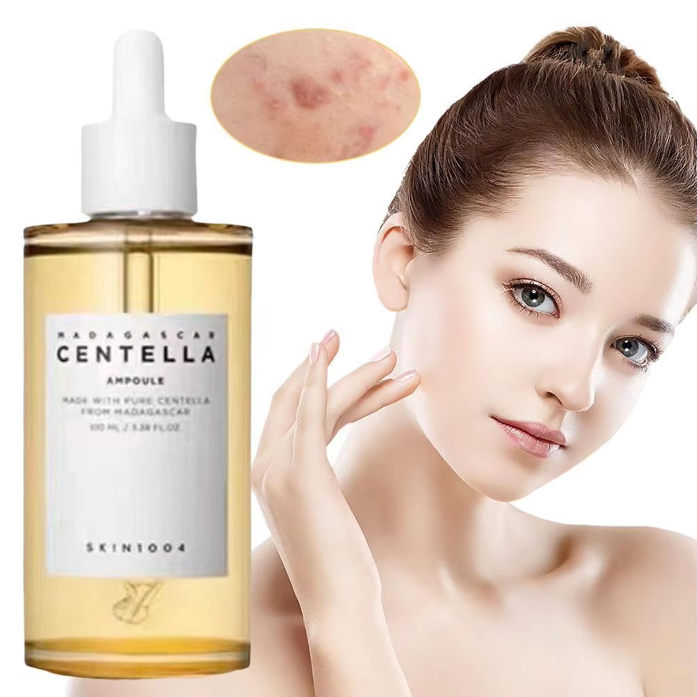 Madagascar Centella Asiatica Ampoule Facial Serum 